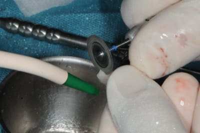 Dsc 1596 e5195w - Eugenol