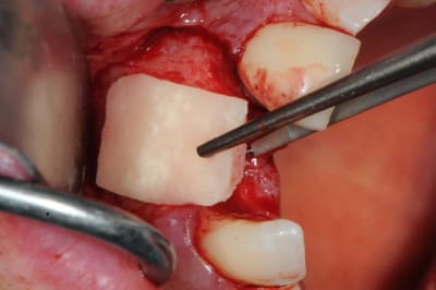 Dsc 1606 hbfqlg - Eugenol