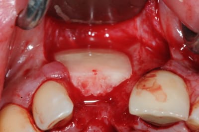 Dsc 1615 gamo3n - Eugenol