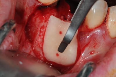 Dsc 1632 ehp3z1 - Eugenol