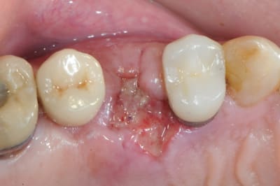 Dsc 1676 tbx0co - Eugenol