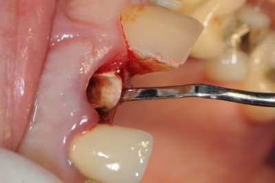 Dsc 1684 swjtqj - Eugenol