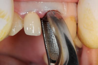 Dsc 1687 egdocx - Eugenol