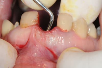 Dsc 1697 hsusaq - Eugenol