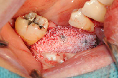 Dsc 1707 hubmly - Eugenol