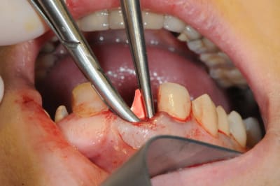 Dsc 1711 wr5fcg - Eugenol