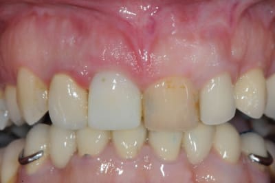 Dsc 1962 nmcw5n - Eugenol