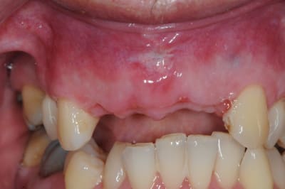 Dsc 1978 drkfx8 - Eugenol