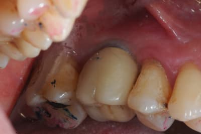Dsc 2224 lxgsrv - Eugenol