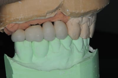 Dsc 2336 e4aywn - Eugenol