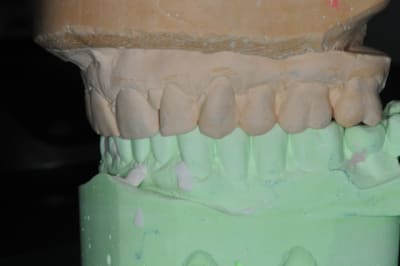 Dsc 2338 btw9vi - Eugenol