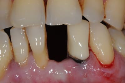 Dsc 2515 xq3zce - Eugenol