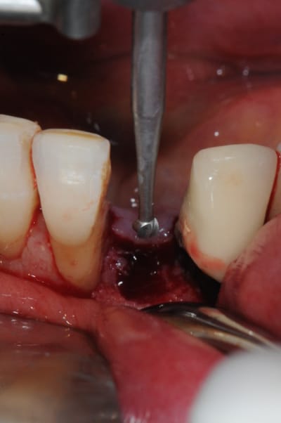 Dsc 2526 stc9ug - Eugenol