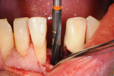 Dsc 2534 q4cisa - Eugenol