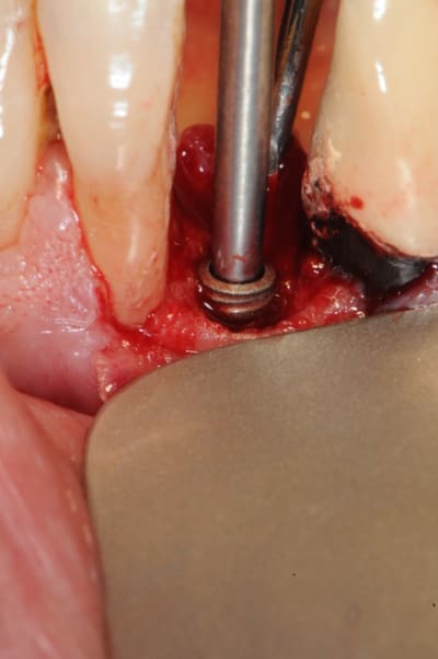 Dsc 2544 kpi8iq - Eugenol