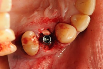 Dsc 2574 whzpkr - Eugenol