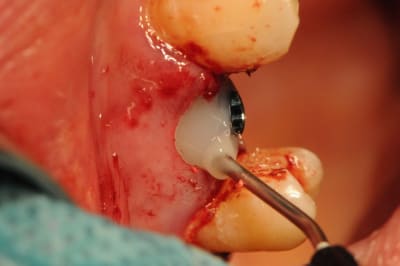 Dsc 2578 psaazp - Eugenol