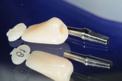 Dsc 2581 zzttlp - Eugenol