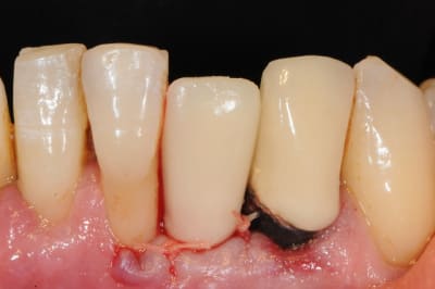 Dsc 2595 dineut - Eugenol