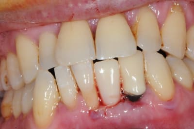 Dsc 2597 sifogs - Eugenol