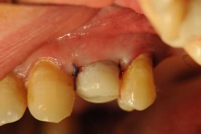 Dsc 2614 chtkfj - Eugenol