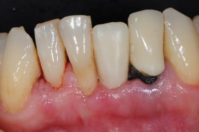 Dsc 2678 sl5k8e - Eugenol