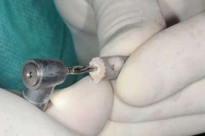 Dsc 2728 mvdis1 - Eugenol