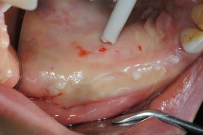 Dsc 2883 fcfxrm - Eugenol