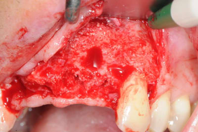 Dsc 2992 qapy4r - Eugenol