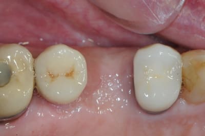 Dsc 3249 tfd2qc - Eugenol