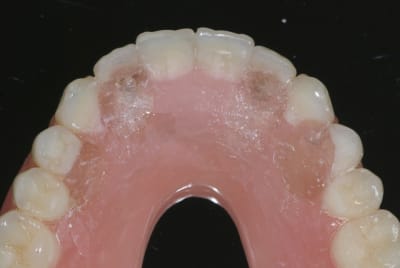 Dsc 3409 gcv7kc - Eugenol