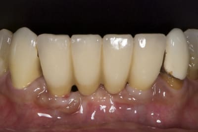 Dsc 3473 y3imdm - Eugenol