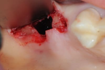 Dsc 3566 h3euht - Eugenol