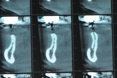 Dsc 3599 srquh6 - Eugenol