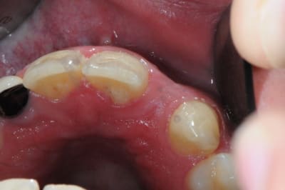 Dsc 3716 brjkvw - Eugenol