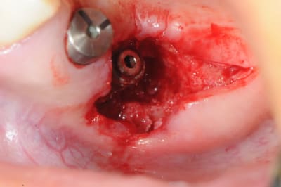 Dsc 3881 jigbb3 - Eugenol