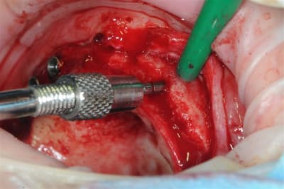 Dsc 3967 e2ji4i - Eugenol