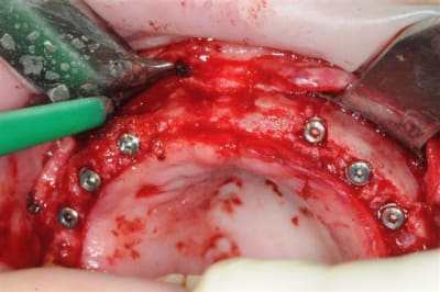 Dsc 3978 c1kq9c - Eugenol