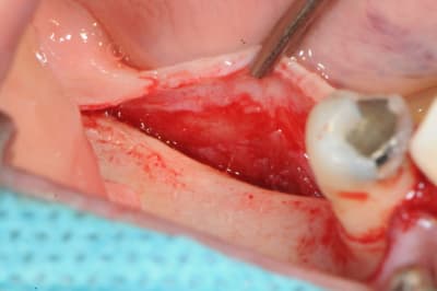 Dsc 4003 qfbqkn - Eugenol