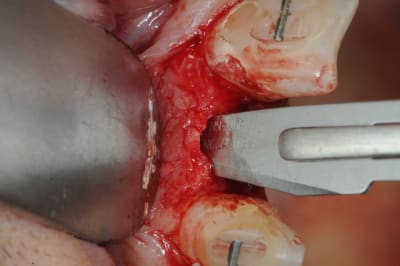 Dsc 4055 otgavx - Eugenol