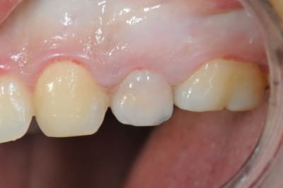 Dsc 4087 tszwph - Eugenol