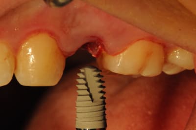 Dsc 4093 rjfwhx - Eugenol