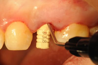 Dsc 4119 kjdb9r - Eugenol