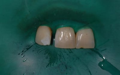 Dsc 4200 nn5zcr - Eugenol