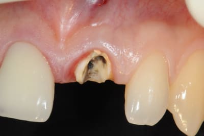 Dsc 4249 vxycld - Eugenol