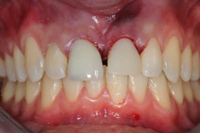 Dsc 4304 pxuqbd - Eugenol