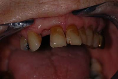 Dsc 4344 wzfqcp - Eugenol