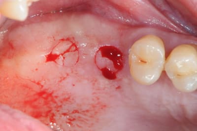 Dsc 4774 uhdtwi - Eugenol