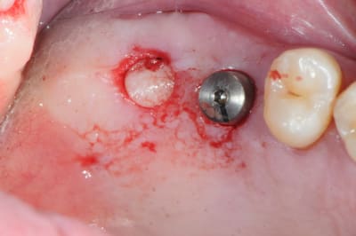 Dsc 4780 nfx67a - Eugenol