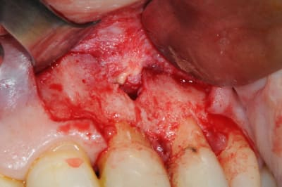 Dsc 4989 k96gfo - Eugenol